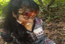 यूपी :बदमाशों ने एक युवती के पिता को WhatsApp पर उसकी बेटी का लहूलुहान फोटो भेजा