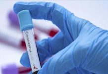 तब्लीगी जमात के संपर्क में आए पांच लोग व एक बच्चे को कोरोना